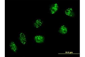Immunofluorescence of purified MaxPab antibody to USP16 on HeLa cell. (USP16 anticorps  (AA 1-822))