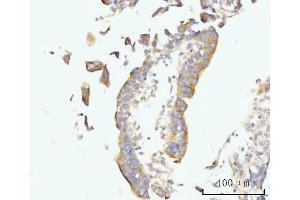 IHC analysis of Golgin 97/GOLGA1 using anti-Golgin 97/GOLGA1 antibody (ABIN7599539). (GOLGA1 anticorps  (AA 1-752))