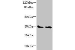 Western blot All lanes: SLC25A36 antibody at 4 μg/mL Lane 1: A431 whole cell lysate Lane 2: A549 whole cell lysate Secondary Goat polyclonal to rabbit IgG at 1/10000 dilution Predicted band size: 35, 15, 18 kDa Observed band size: 35 kDa (SLC25A36 anticorps  (AA 58-110))