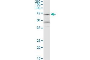 LRRN1 monoclonal antibody (M05), clone 3D11. (LRRN1 anticorps  (AA 1-716))