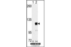 Western blot analysis of PUM2 using PUM2 Antibody (S182) using 293 cell lysates (2 ug/lane) either nontransfected (Lane 1) or transiently transfected with the PUM2 gene (Lane 2).