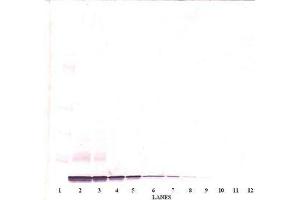 Image no. 2 for anti-Chemokine (C-X-C Motif) Ligand 14 (CXCL14) antibody (ABIN465239) (CXCL14 anticorps)