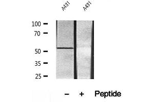 Western blot analysis of extracts of A431 cells, using UBAP1 antibody. (UBAP1 anticorps)