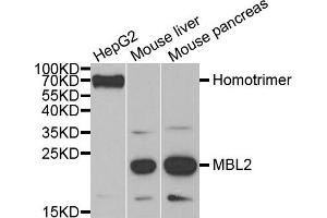 Western blot analysis of extracts of various cell lines, using MBL2 antibody. (MBL2 anticorps)