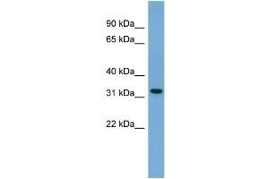 WB Suggested Anti-Gjb3 Antibody Titration: 0. (Connexin 31 anticorps  (N-Term))