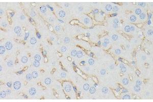 Immunohistochemistry of paraffin-embedded Mouse liver using IFITM1 Polyclonal Antibody at dilution of 1:100 (40x lens). (IFITM1 anticorps)