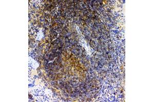 IHC analysis of GRK2 using anti-GRK2 antibody (ABIN5693069).
