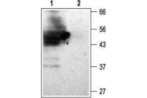 Western blot analysis of rat kidney membranes: - 1.