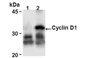 Western Blotting (WB) image for anti-Cyclin D1 (CCND1) antibody (ABIN1106871) (Cyclin D1 anticorps)