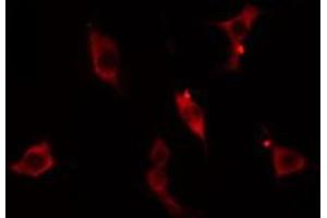 ABIN6275093 staining  Hela cells by IF/ICC. (RNF125 anticorps  (Internal Region))