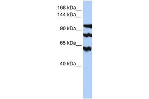 WB Suggested Anti-PPP1R13B  Antibody Titration: 0. (PPP1R13B anticorps  (Middle Region))