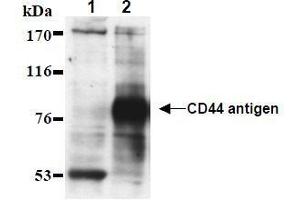 Western Blotting (WB) image for anti-CD44 (CD44) antibody (ABIN1449180) (CD44 anticorps)