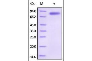 SDS-PAGE (SDS) image for Interleukin 12 beta (IL12B) (AA 23-328) protein (Fc Tag) (ABIN2181332)