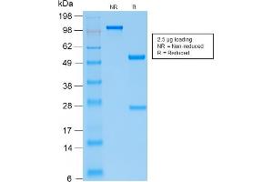 SDS-PAGE Analysis Purified PTH Monospecific Recombinant Rabbit Monoclonal Antibody (PTH/2295R).