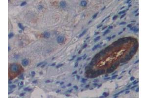 DAB staining on IHC-P; Samples: Human Liver Tissue (LSR anticorps  (AA 335-589))