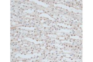 Immunohistochemistry of paraffin-embedded Mouse kidney using ZNF562 Polyclonal Antibody at dilution of 1:100 (40x lens). (ZNF562 anticorps)