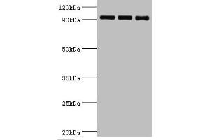 Western blot All lanes: Heat shock protein 105 kDa antibody at 1 μg/mL Lane 1: MCF-7 whole cell lysate Lane 2: Hela whole cell lysate Lane 3: Mouse brain tissue Secondary Goat polyclonal to rabbit IgG at 1/10000 dilution Predicted band size: 97, 93, 98 kDa Observed band size: 97 kDa (HSPH1 anticorps  (AA 659-858))