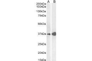 ABIN190828 (0. (Liver Arginase anticorps  (C-Term))