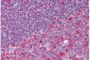 Human Tonsil: Formalin-Fixed, Paraffin-Embedded (FFPE) (RHBDD3 anticorps  (Internal Region))