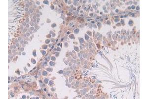 anti-Interleukin 4 (IL4) (AA 61-111) antibody