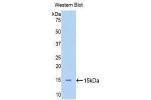 Western Blotting (WB) image for anti-Mannan-Binding Lectin serine Peptidase 2 (MASP2) (AA 170-287) antibody (ABIN1173814) (MASP2 anticorps  (AA 170-287))