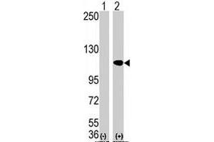 Western blot analysis of AOF2 (arrow) using AOF2 polyclonal antibody . (LSD1 anticorps  (N-Term))