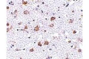 Immunohistochemistry (IHC) image for anti-Mesencephalic Astrocyte-Derived Neurotrophic Factor (MANF) (C-Term) antibody (ABIN1030505) (MANF anticorps  (C-Term))