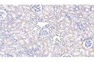 Detection of IGFBP2 in Bovine Kidney Tissue using Polyclonal Antibody to Insulin Like Growth Factor Binding Protein 2 (IGFBP2)