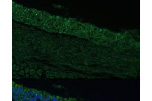 Immunofluorescence analysis of Rat bronchus cells using IL25 Polyclonal Antibody at dilution of 1:100.