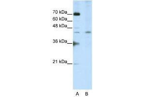 SURF6 antibody used at 2. (SURF6 anticorps  (Middle Region))