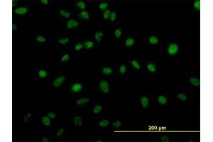 Image no. 4 for anti-Zinc Finger Protein 207 (ZNF207) (AA 1-111) antibody (ABIN599016) (ZNF207 anticorps  (AA 1-111))