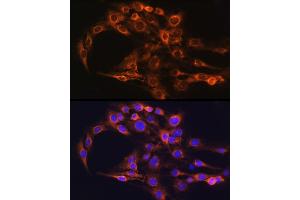 Immunofluorescence analysis of C6 cells using FCGRT Rabbit pAb (ABIN6127922, ABIN6140552, ABIN6140553 and ABIN6224639) at dilution of 1:100 (40x lens). (FcRn anticorps  (AA 25-300))