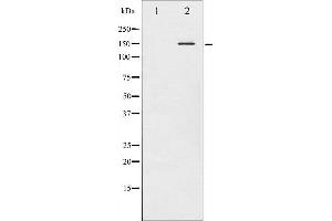 Western blot analysis of Met phosphorylation expression in HepG2 whole cell lysates,The lane on the left is treated with the antigen-specific peptide.