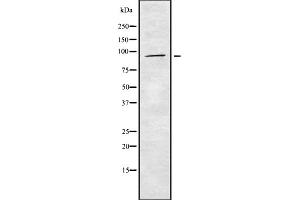 Western blot analysis of Matriptase using A549 whole cell lysates (ST14 anticorps  (Internal Region))