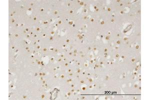 Immunoperoxidase of monoclonal antibody to ZIC4 on formalin-fixed paraffin-embedded human cerebral cortex. (ZIC4 anticorps  (AA 1-90))