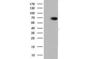 Western Blotting (WB) image for anti-Peroxisomal Biogenesis Factor 5 (PEX5) antibody (ABIN1500157) (PEX5 anticorps)