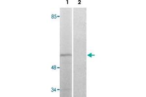 Western blot analysis of Lane 1: COLO205 cells Lane 2: antigen-specific peptide treated COLO205 cells with STK39 (phospho S309) polyclonal antibody .