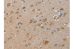 The image on the left is immunohistochemistry of paraffin-embedded Human brain tissue using ABIN7130528(PAGE2 Antibody) at dilution 1/20, on the right is treated with fusion protein. (PAGE2 anticorps)