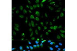 Immunofluorescence analysis of MCF-7 cells using PSMA3 Polyclonal Antibody (PSMA3 anticorps)