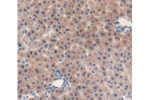 Used in DAB staining on fromalin fixed paraffin- embedded liver tissue
