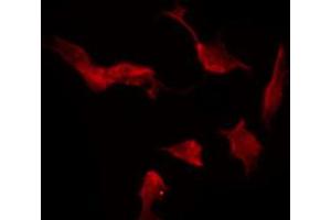 ABIN6272359 staining Hela by IF/ICC.