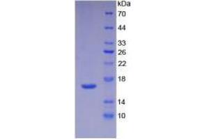 Image no. 3 for Interleukin 16 (IL16) (AA 1203-1332) (Active) protein (His tag) (ABIN5665840)