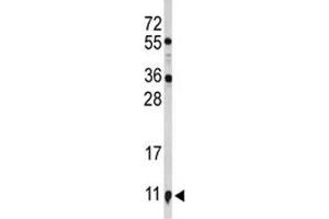 Western blot analysis of S100A10 antibody and NCI-H460 lysate. (S100A10 anticorps  (AA 12-40))