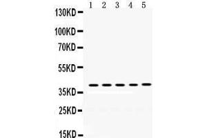 Western Blotting (WB) image for anti-Oncostatin M (OSM) (AA 26-220) antibody (ABIN3043458) (Oncostatin M anticorps  (AA 26-220))