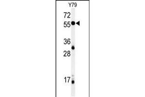 Western blot analysis of NOB1 Antibody in Y79 cell line lysates (35ug/lane) (NOB1 anticorps  (C-Term))