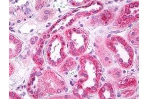 Image no. 1 for anti-Solute Carrier Family 6 (Neurotransmitter Transporter, GABA), Member 11 (SLC6A11) (C-Term) antibody (ABIN1107329)