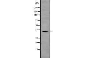 Western blot analysis of GNB2 using LOVO whole  lysates.
