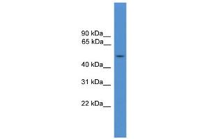WB Suggested Anti-IL7R Antibody Titration: 0. (IL7R anticorps  (Middle Region))