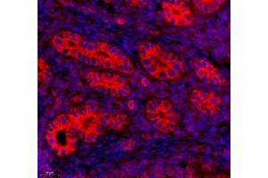 Immunofluorescence of paraffin embedded mouse uterus using Tuba3a (ABIN7076051) at dilution of 1: 600 (450x lens) (Tuba3a anticorps)