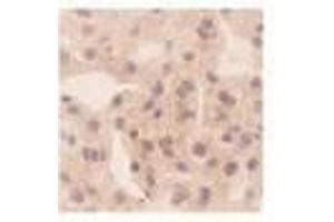 Image no. 1 for anti-Chemokine (C-X-C Motif) Ligand 10 (CXCL10) antibody (ABIN791563)